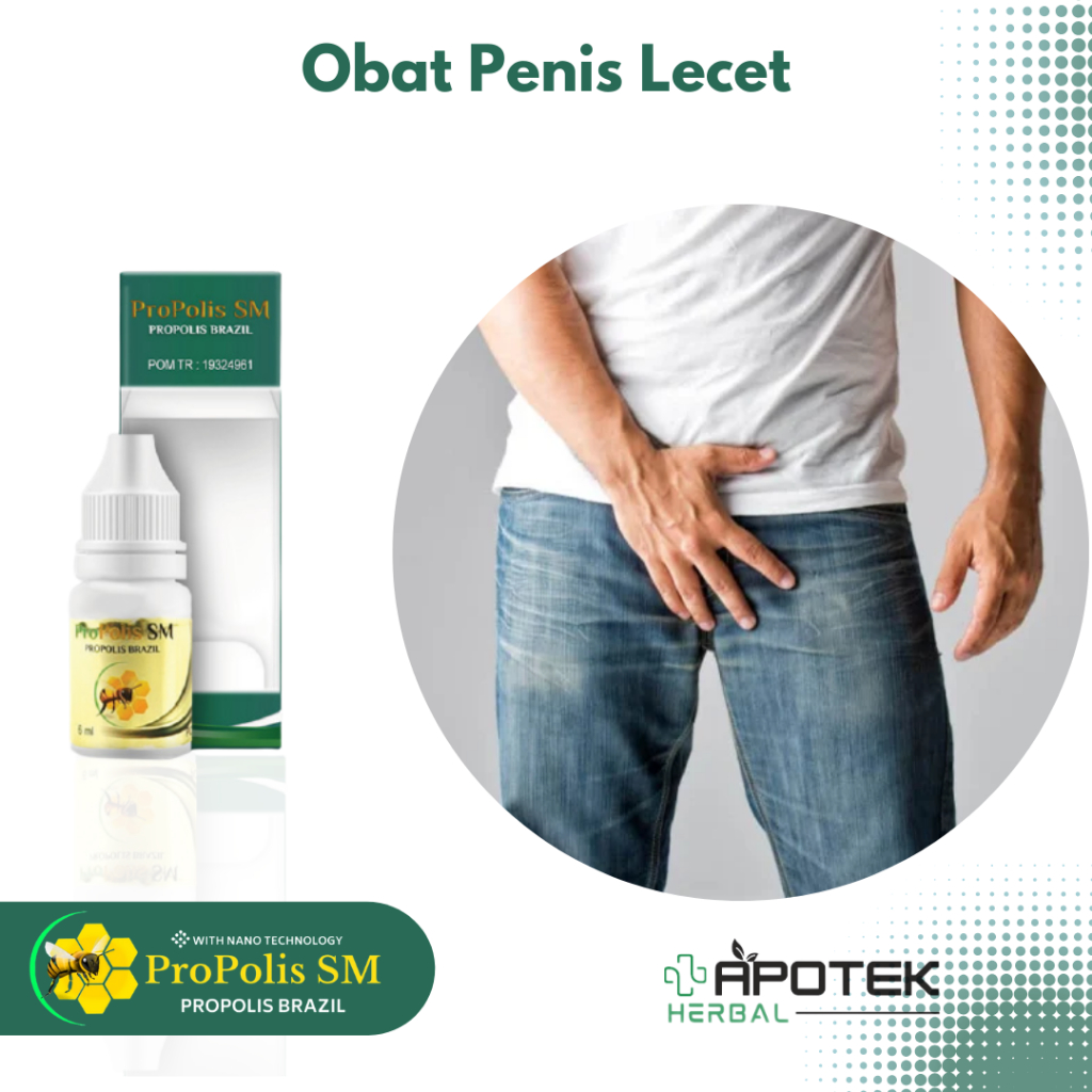 Obat Penis Lecet, Luka Batang Kelamin Pria, Kepala Penis Lecet, Luka, Gesekan, Perih, Kulit Penis Me