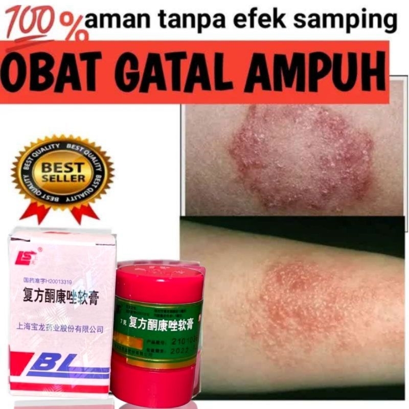 Salep BL Original 100% asli obat Salep Gatal Eksim Panu Kurap kutu air ampuh