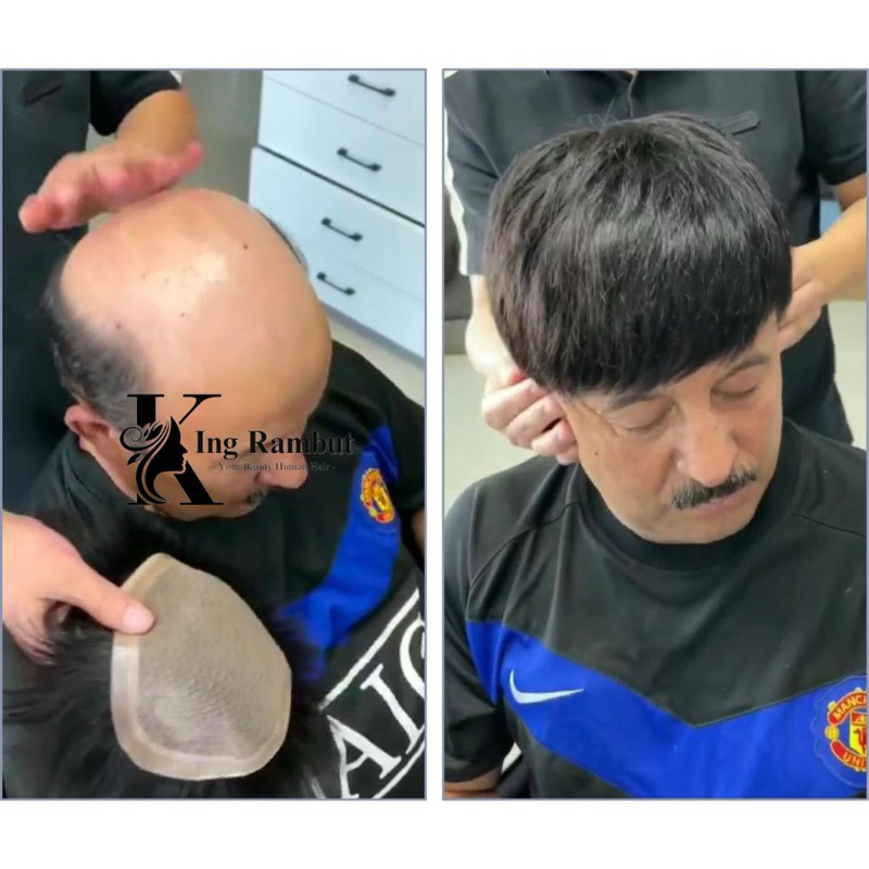 TL08 KINGRAMBUT- Hair Skin Toupee Pria Rambut Asli