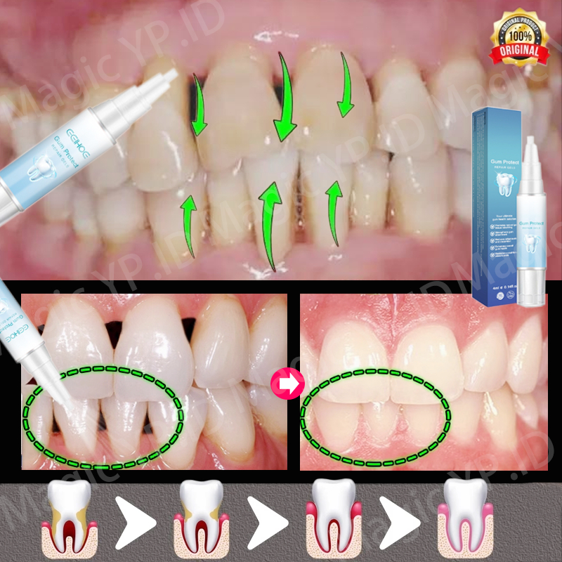 penguat gigi goyang obat sakit gigi obat gusi bengkak gumshield obat gusi bengkak
