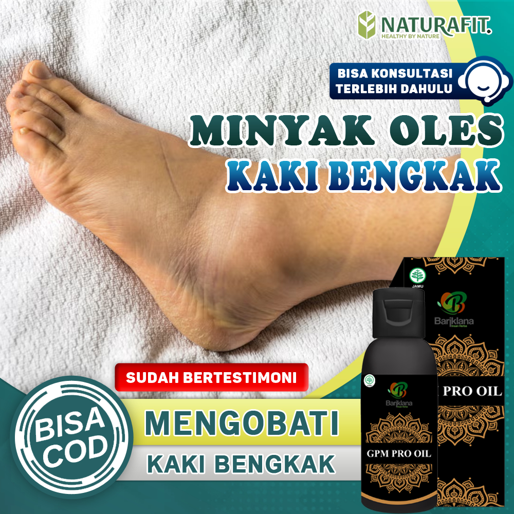 Minyak Oles Kaki Bengkak Paling Ampuh, Terkilir, Keseleo, Badan Pegal Pegal, Obat Cedera Tulang Dan 
