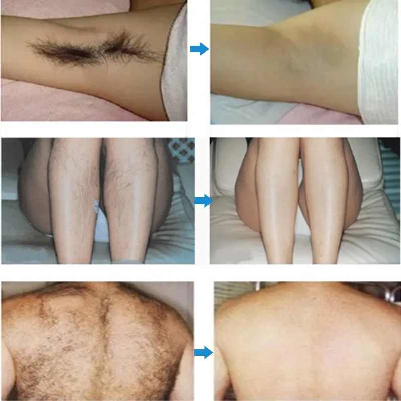 RB Perontok bulu miss v permanen bpom perontok bulu kemaluan permanen pembersih bulu ketiak dan miss