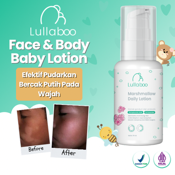 Lullaboo Lotion Bayi Pelembab Kulit Bayi - Face & Body - Atasi Biang Keringat, gatal , kulit kemerah