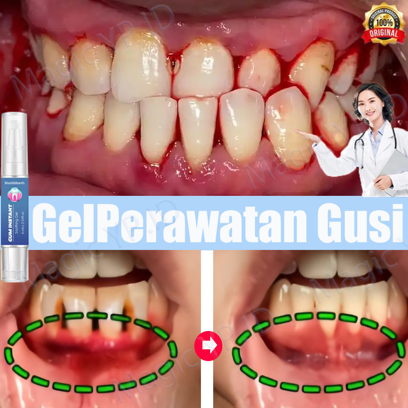 gumshield obat gusi bengkak obat sakit gigi ampuh obat sakit gigi paling penguat gigi goyang gigi go