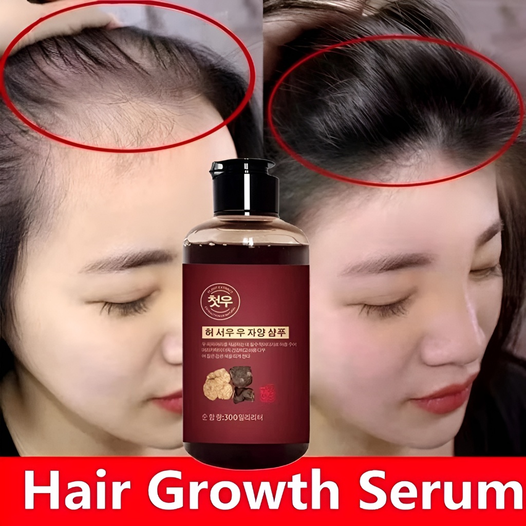 Shampoo Blackening Yurizumi Mencegah Kerontokan dan Menghitamkan Rambut Beruban