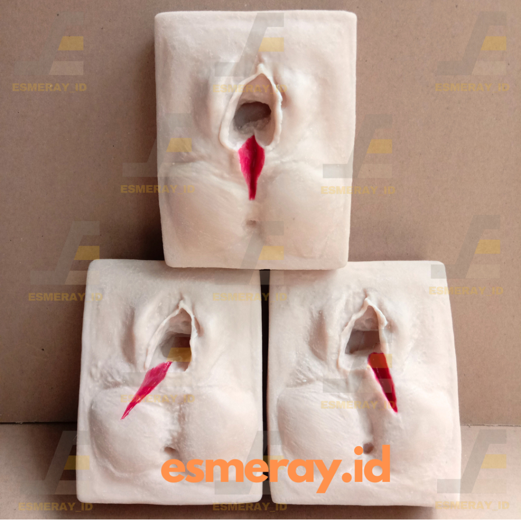 Phantom/Manekin/Manikin Praktek Episiotomi Insisi Perineum 3pcs (Sayatan Kiri/Tengah/Kanan