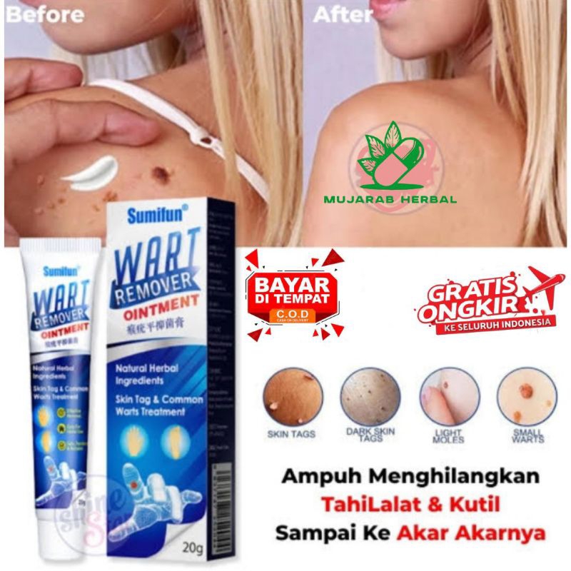 Cream Obat Kutil Dan Tahi Lalat Sumifun Penghilang Kutil Dan Tahi Lalat