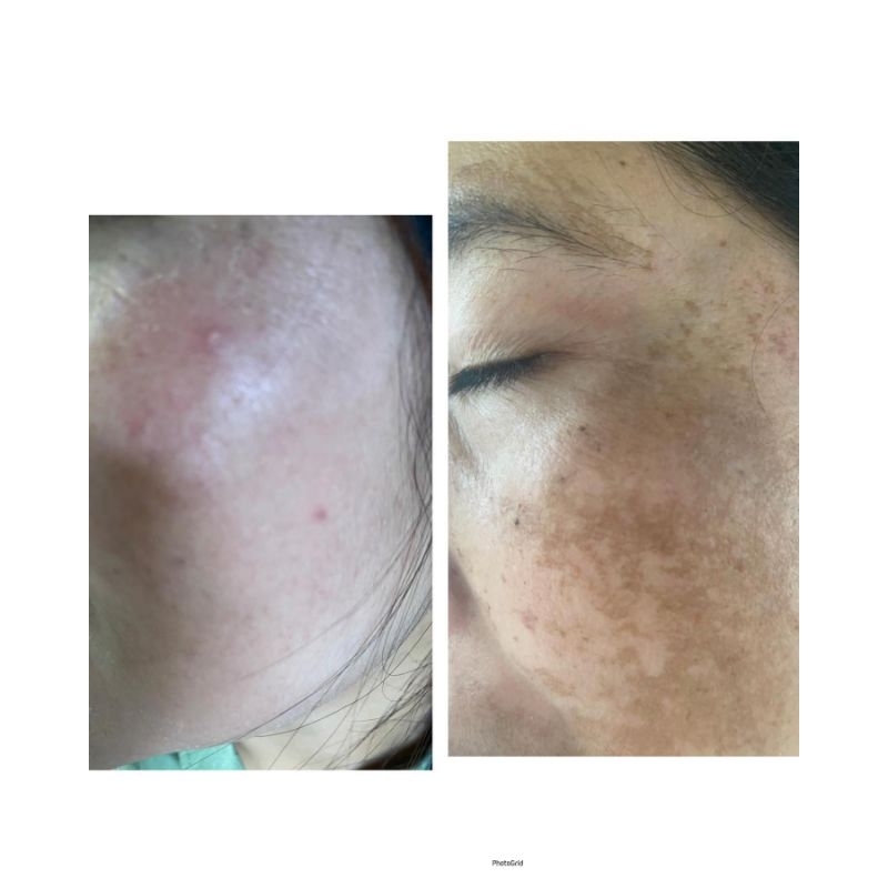 ( TERMURAH & ORIGINAL )TOHKY BEAUTY PAKET LUXURY / TOHKI BEAUTY SKINCARE PAKET LUXURY / TOHKY BEAUTY