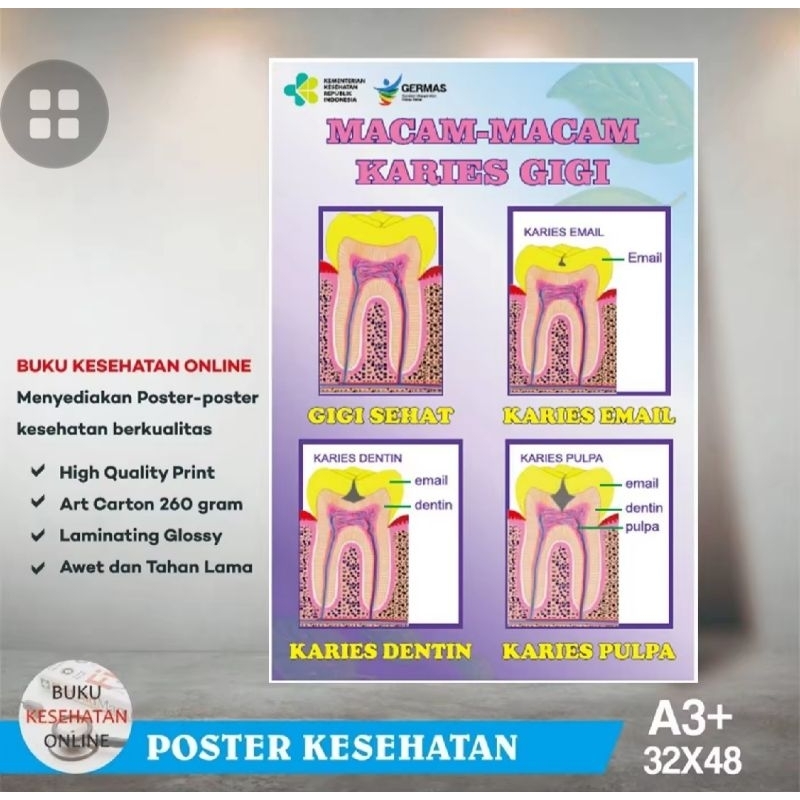 Poster Kedokteran Gigi Ukuran A3+ ( 32 x 48 ) Poster Gosok gigi klinik / macam macam karies gigi / p