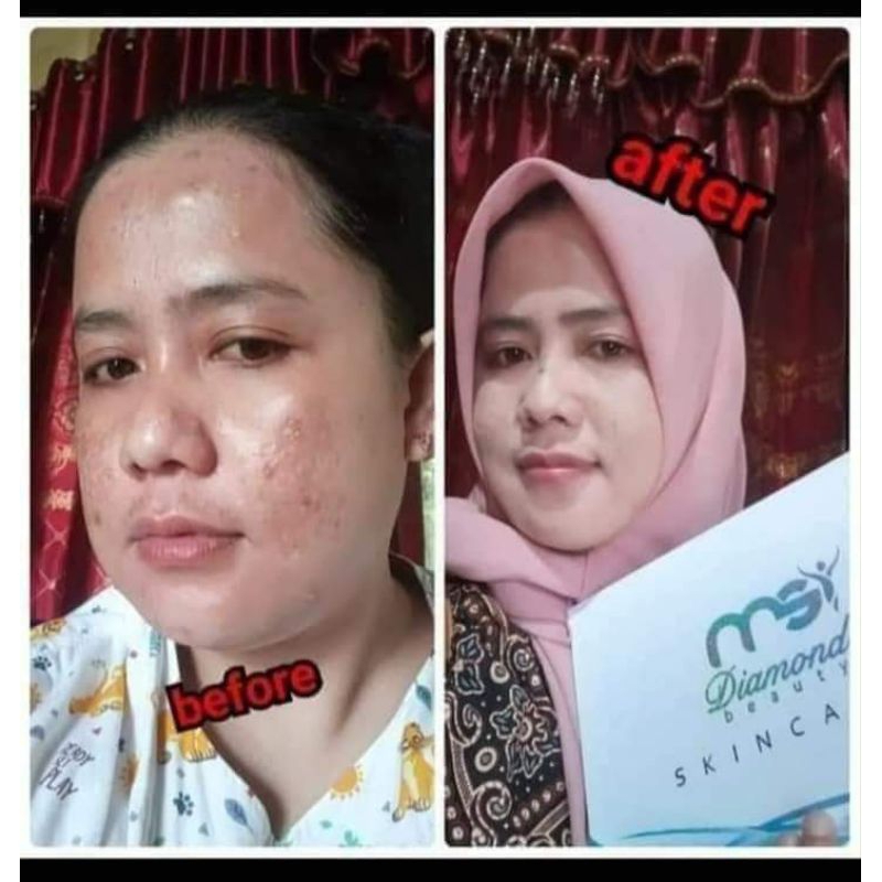 MSI Diamond Beauty Skincare