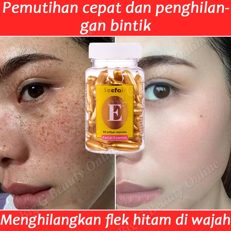 Menghilangkan Flek Hitam Di Wajah 60 Kapsul Vitamin E Serum Wajah Pemutih Wajah Skincare Flek Hitam 