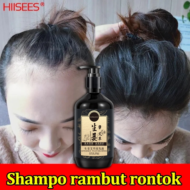 Sampo Penumbuh Rambut Cepat Membantu Penumbuh Rambut Botak Shampoo Anti Rontok 300ml Herbal Essences