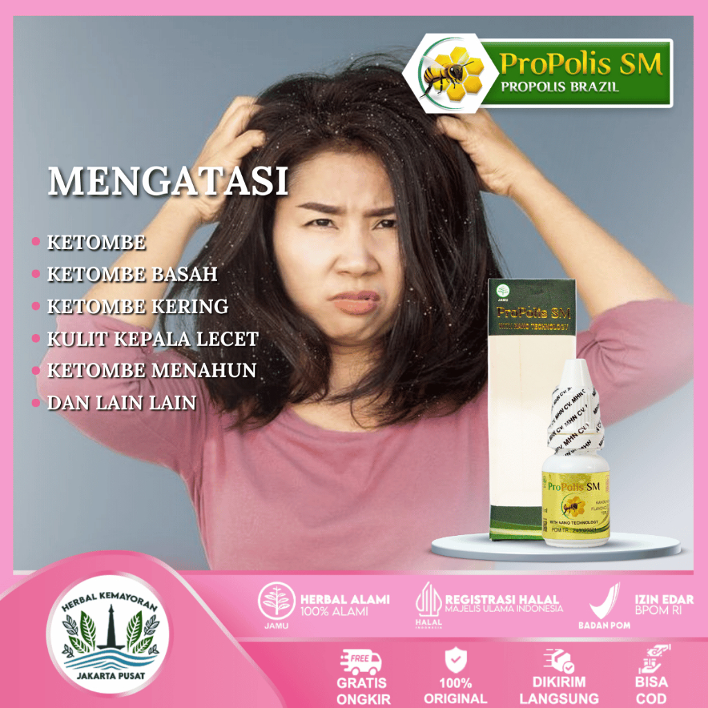 

Obat Gatal Kulit Kepala, Ketombe Parah, Berkerak - Herbal PROPOLIS SM Brazil ASLI Jakarta Pusat