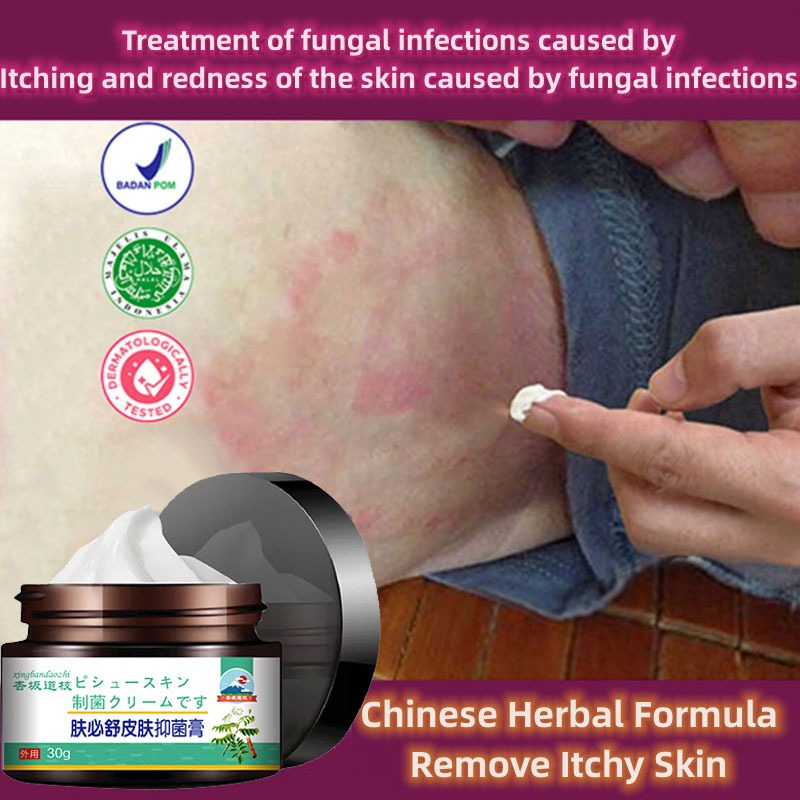 【100%ORI】Salep gatal paling ampuh obat gatal selangkangan salap gatal kulit yang ampuh obat gatal pa