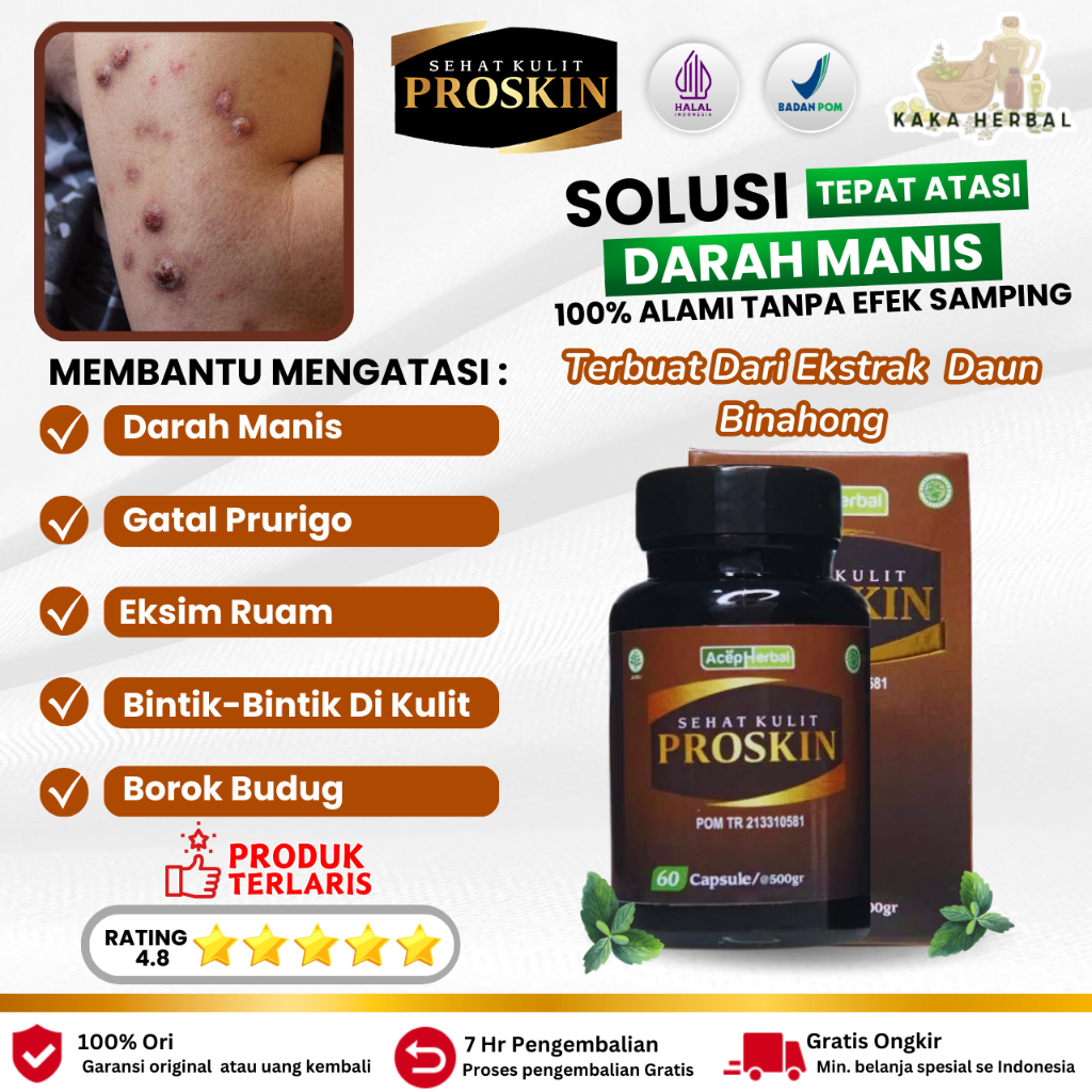 Kaka Herbal - Obat Darah Manis, Obat Penyakit Prurigo, Obat Gatal Gatal Pada Kulit, Penghilang Bekas
