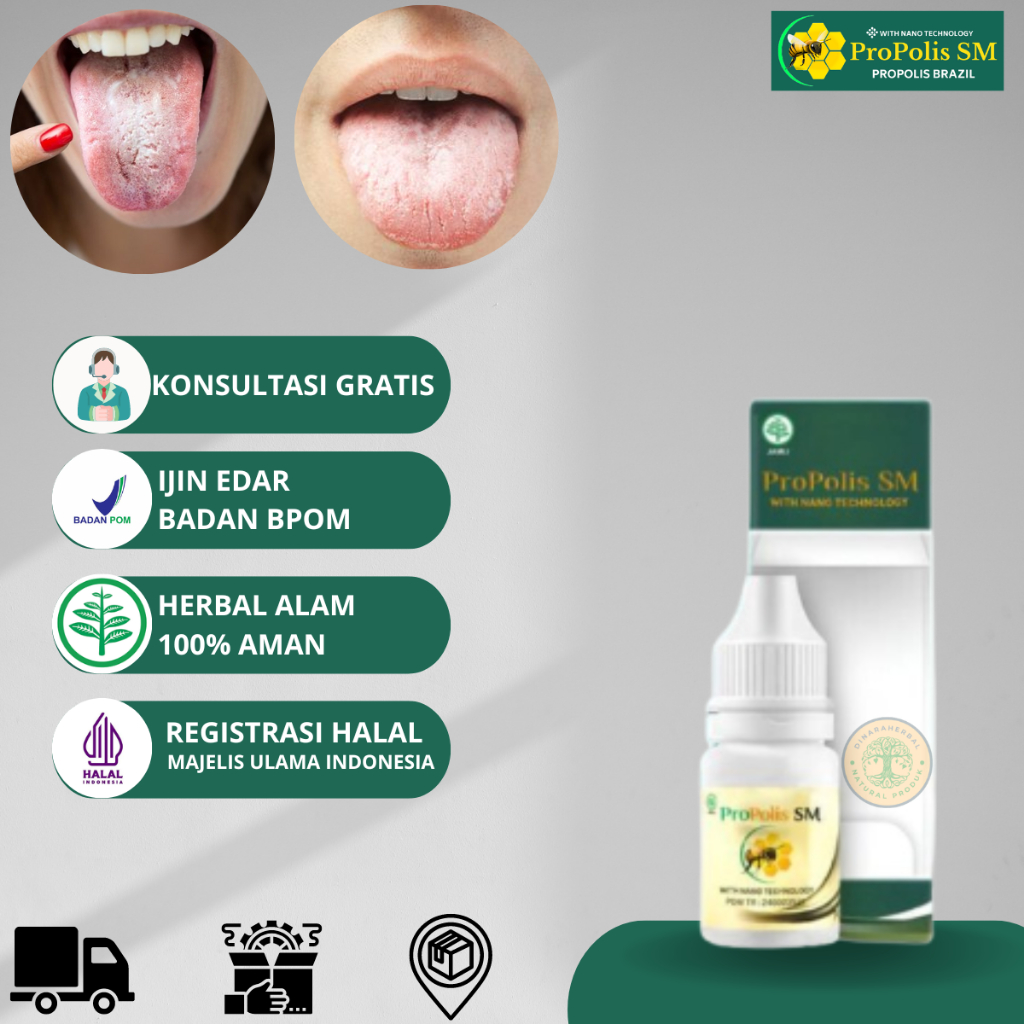 Obat Lidah Berjamur Anak & Dewasa, Pembersih Lidah Putih, Lidah Putih Terasa Pahit, Obat Lidah Mati 