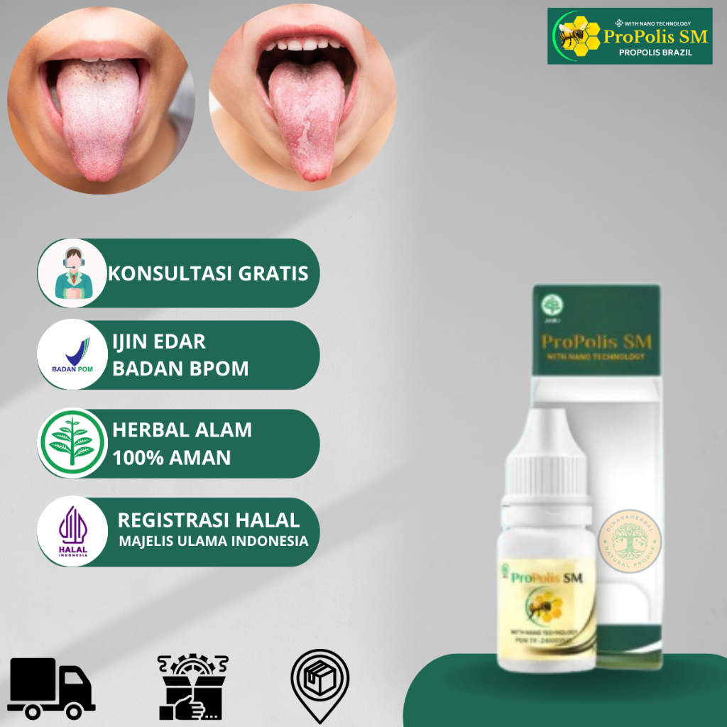 Obat Lidah Putih, Obat Kandidiasis Mukokutan, Obat Lidah Putih Berjamur, Lidah Mati Rasa Anak & Dewa