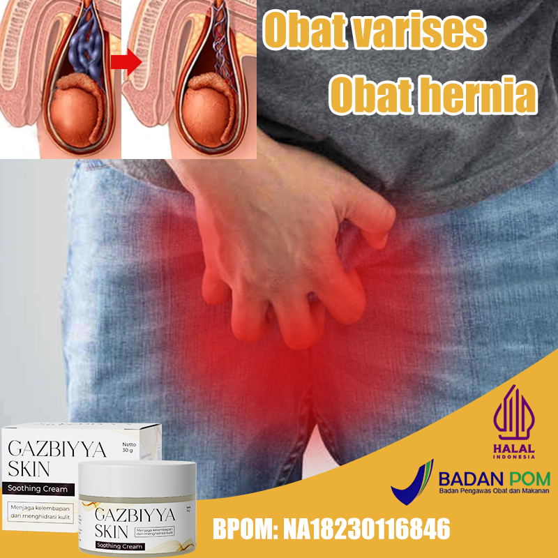 Obat hernia Obat varikokel Obat saraf kejepit 30g obat varises Paling Ampuh Bengkak Benjolan di Buah