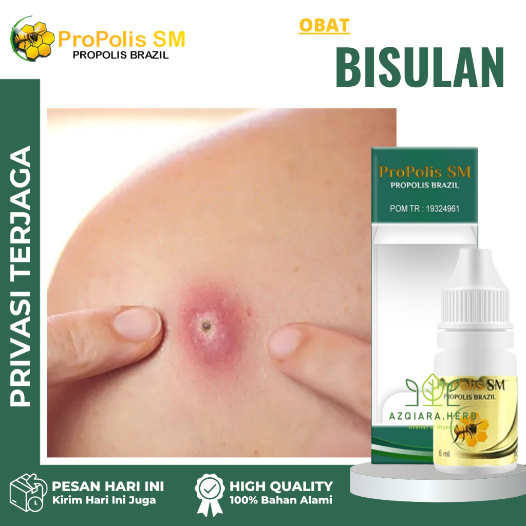 Obat Bisul Bernanah, Obat Bisul Bengkak, Obat Tetes Bisulan di Ketiak, Obat Tetes Bisulan di Area Ke