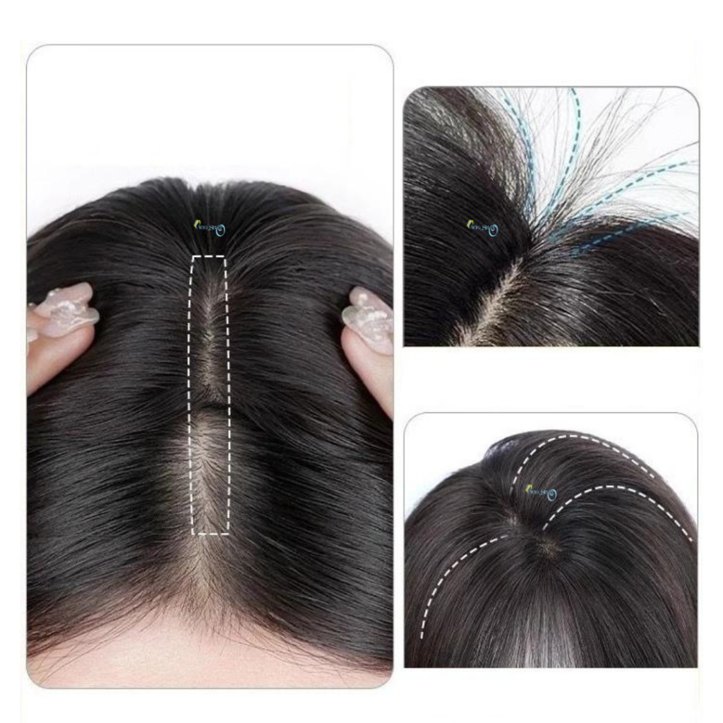 Tutup Botak Wanita / Toupee / Wig Penutup Botak Wanita