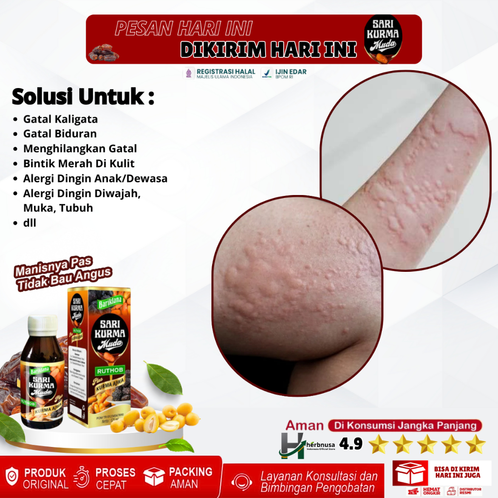 Obat Kaligata Gatal Gatal, Obat Kaligata Biduran, Obat alergi Kaligata, Obat Bentol Biduran, Obat He
