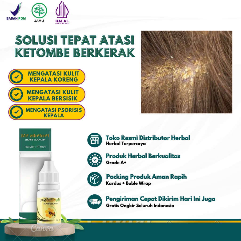 Obat Penghilang Gatal di Kulit Kepala, Obat Penghilang Ketombe Di Kepala, Obat Borok Kulit Kepala, O
