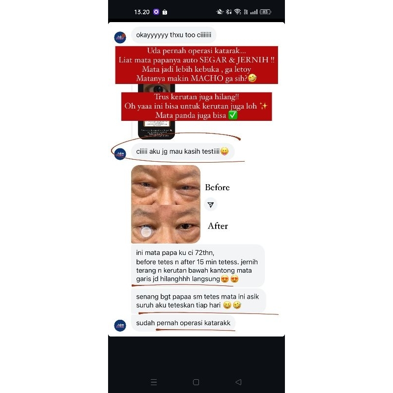 AII VISION EYE SERUM (FORSKIN) 5ML