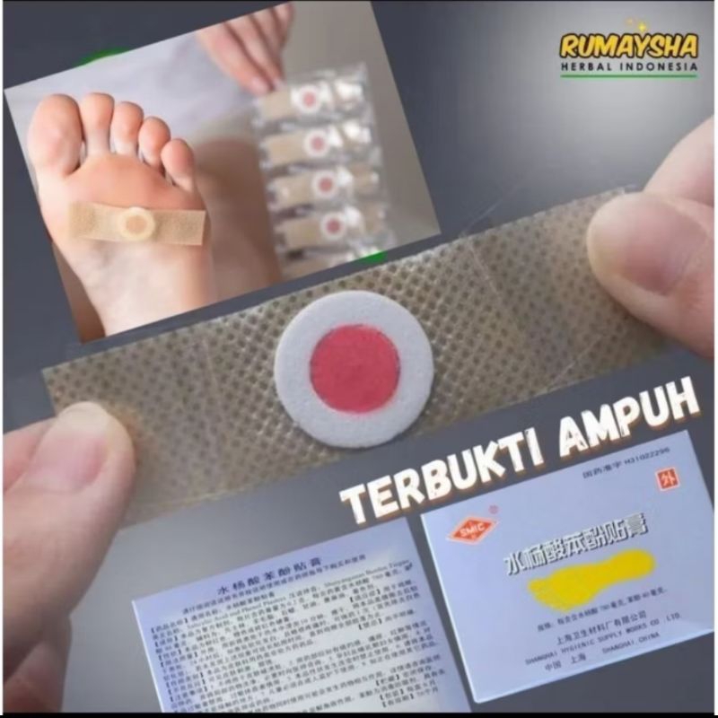 plester obat kutil dan mata ikan ampuh