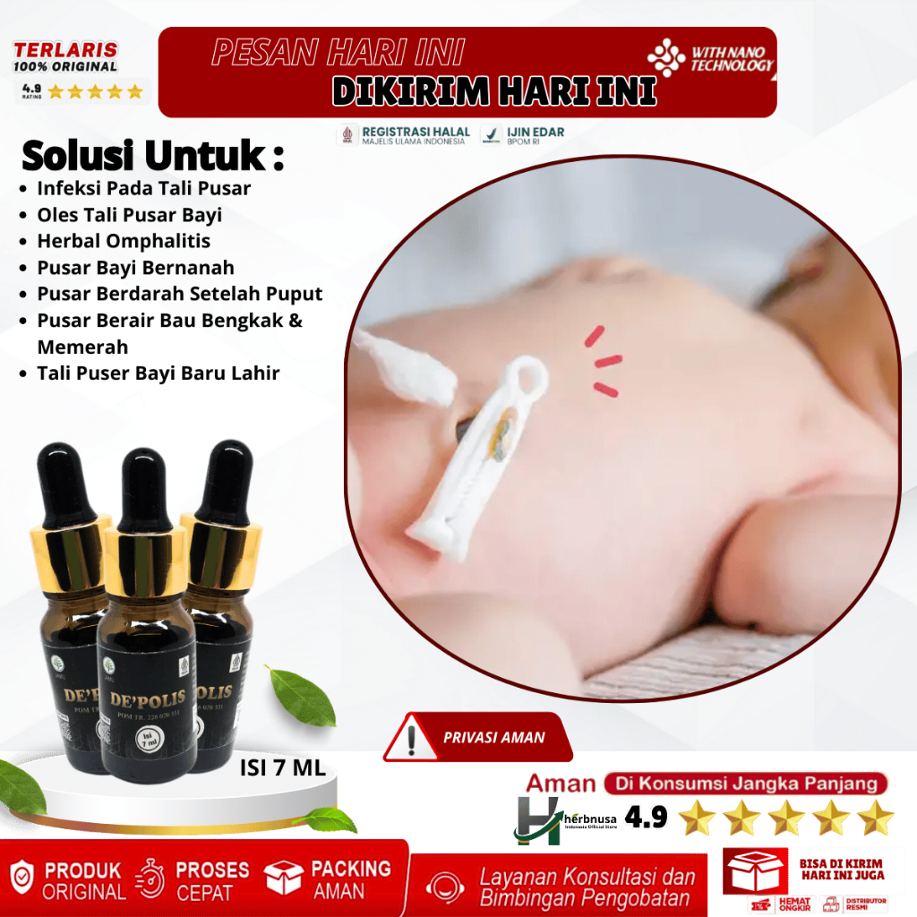 Obat Infeksi Pada Tali Pusar - Obat Oles Tali Pusar Bayi, Obat Herbal Omphalitis, Obat Pusar Bayi Be