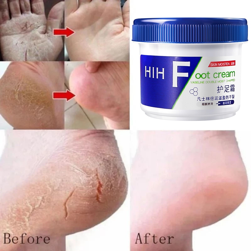 RB Vaseline kaki pecah dan kering Foot cream 40g Obat kaki pecah Pelembab kaki kering dan pecah