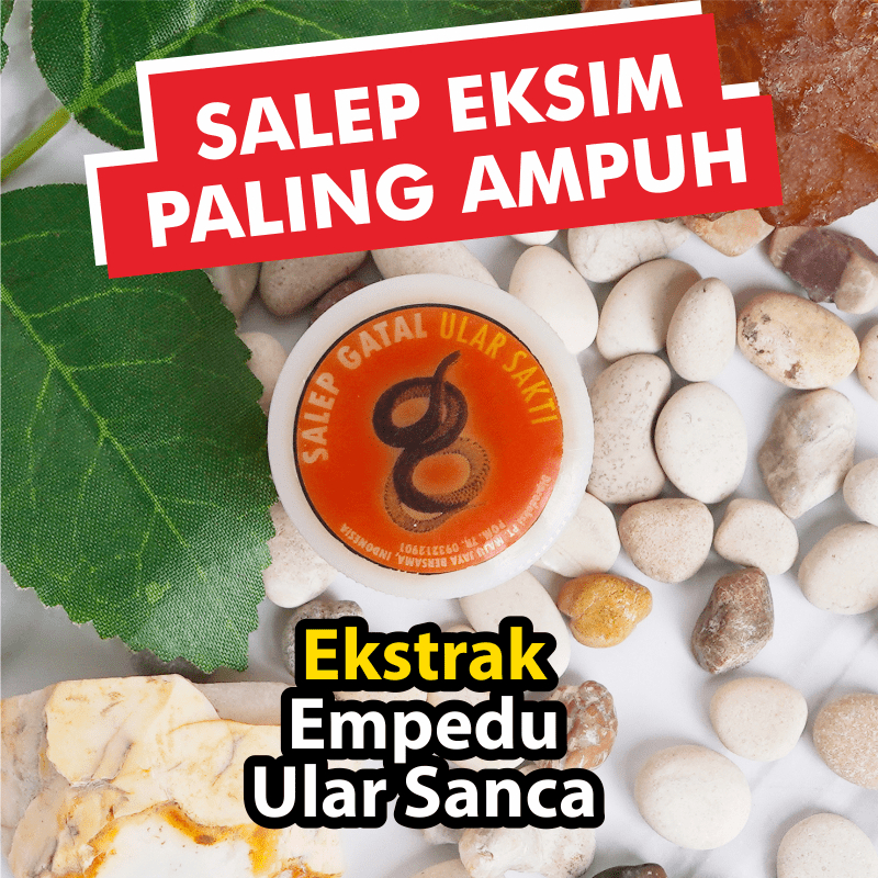 Salep Obat Gatal Kulit Eksim Kering Paling Ampuh Gatel Exim Salap Gatal Kurap Panu Kutu Air Psoriasi