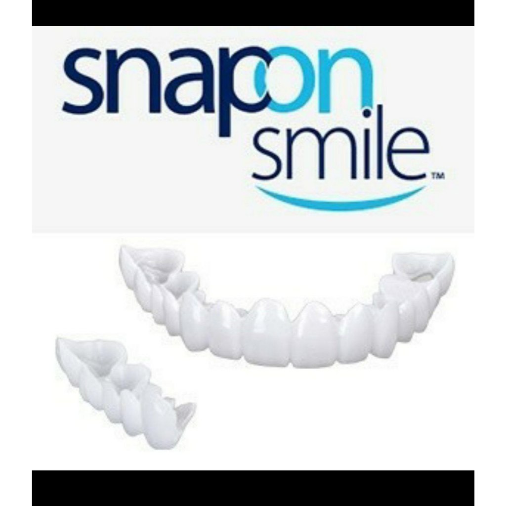 Veneer instan perapi gigi OS