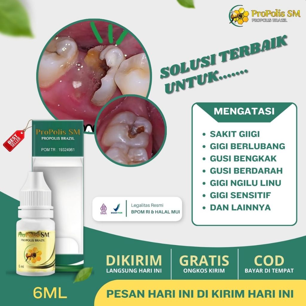Obat Sakit Gigi Berlubang, Obat Sakit Gigi Dan Gusi, Obat Sakit Gigi Anak dan Dewasa