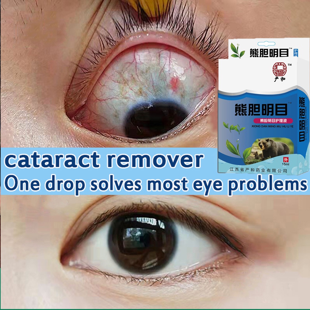 Obat tetes mata Obat tetes mata Mata kering Mata perih Kemerahan Mata lelah Penglihatan kabur Mata k