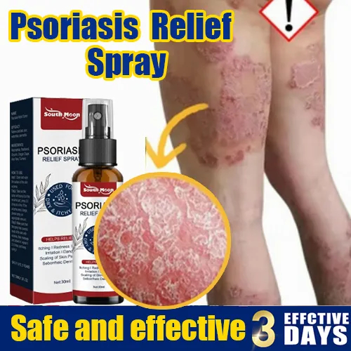100% efektif-Semprot psoriasis30ML salep gatal selangkangan salep eksim kering paling ampuh paling a