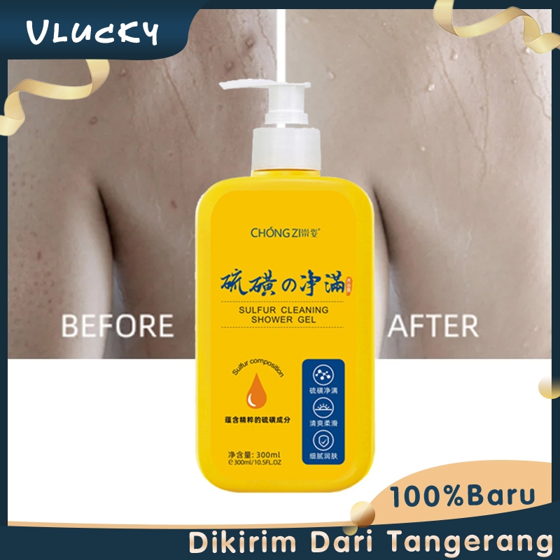 Sabun Cair 300ml Sabun Gatal Sulfur Cair Mandi Belerang Sulfur Bodywash