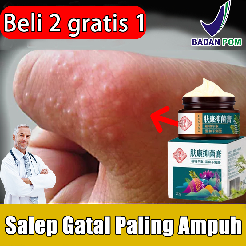 obat gatel kulit paling ampuh salep gatal paling ampuh salap gatal kulit yang ampuh salep exim kerin