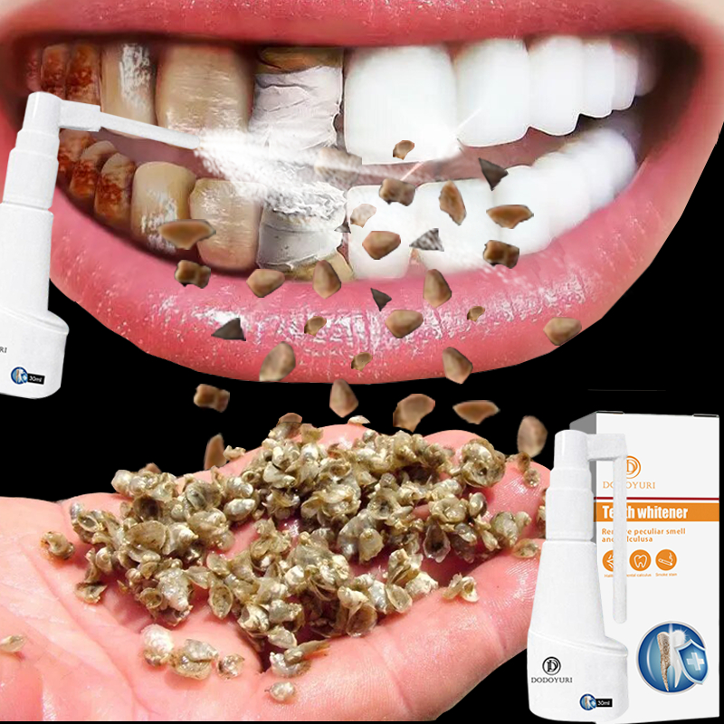 Pasta gigi pemutih Perontok karang gigi Perontok karang gigi paling ampuh Alat pembersih karang gigi