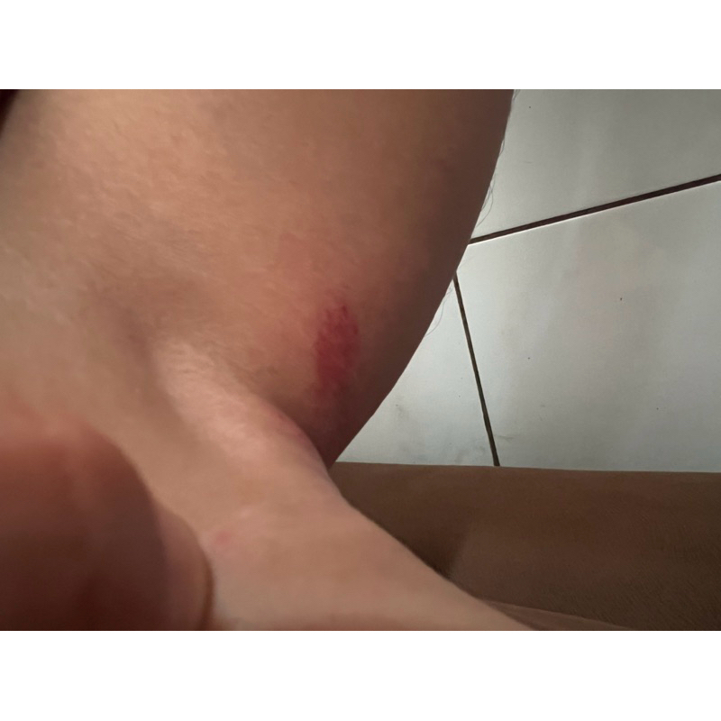 salep gatal perih saat panen rumah burung walet