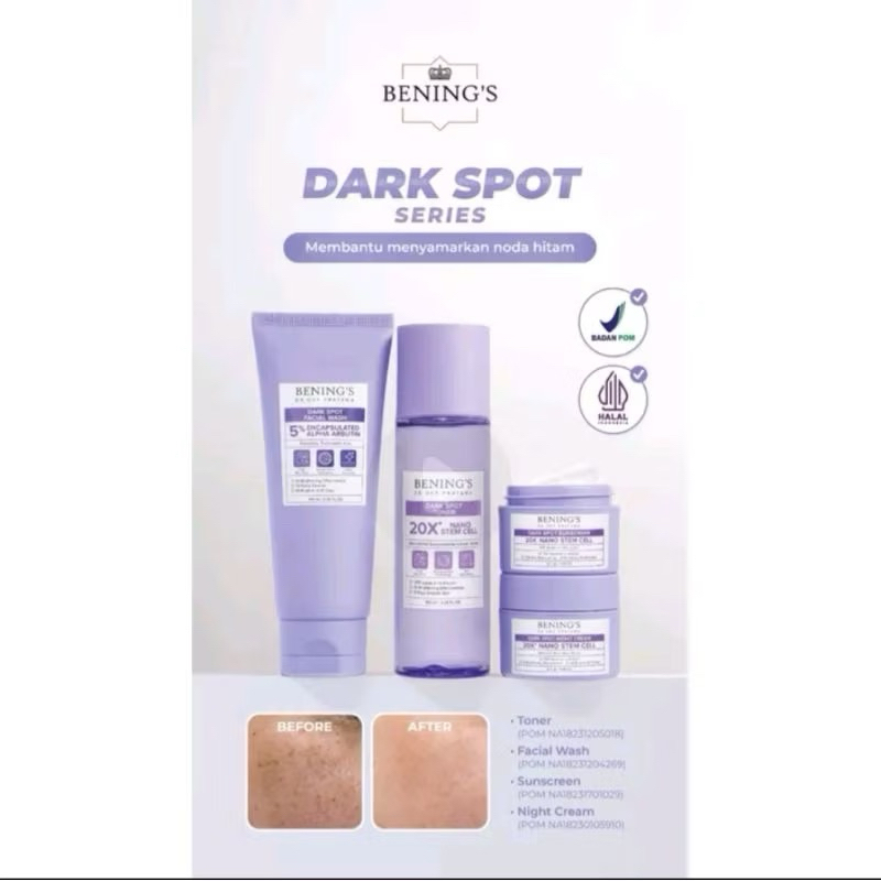 EXCLUSIVE SKINCARE (FLEK) DR. OKY PRATAMA | BENING'S CLINIC | Bening Skincare || Klinik Benings