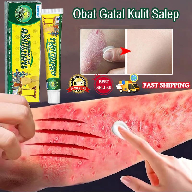 Obat Gatal Kulit Salep 20g Eksim Jamur Dermatitis Alergi Kulit Cream  Anti Gatal Cream Menghambat De
