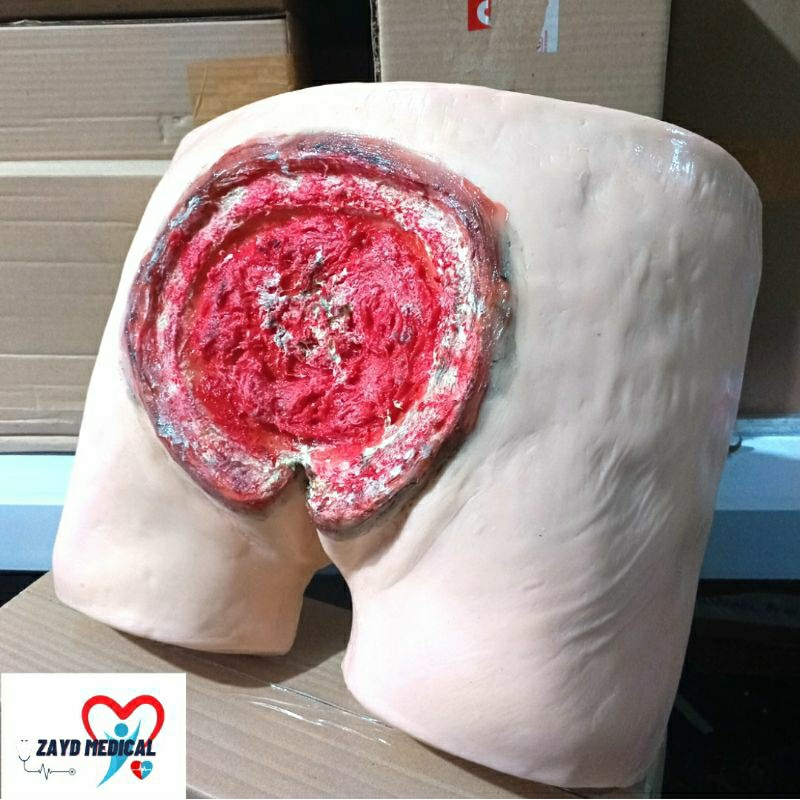 PHANTOM MANIKIN BOKONG DECUBITUS SILICONE/ MANIKIN DECUBITUS