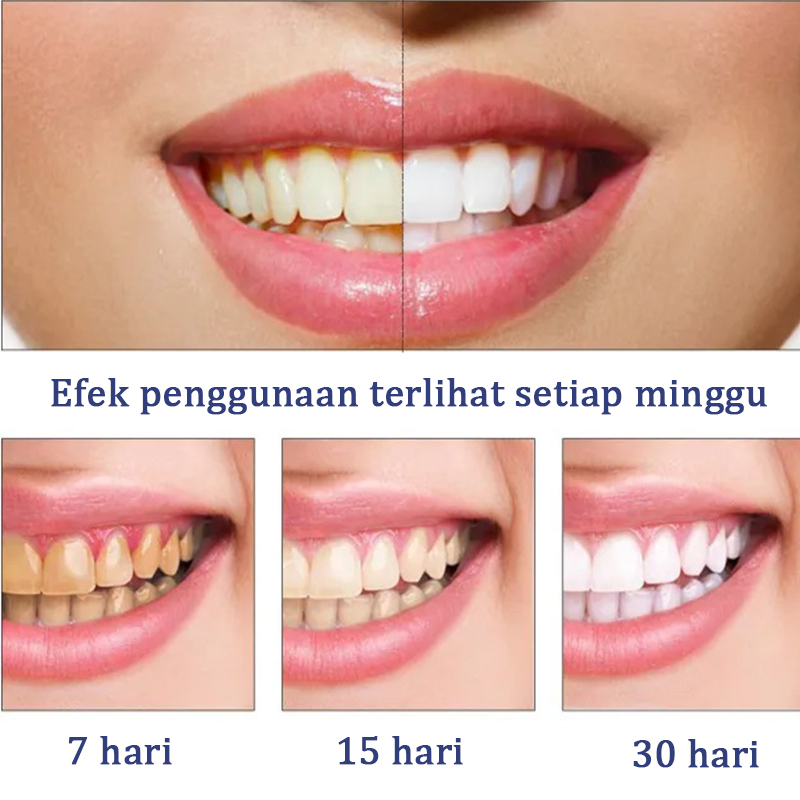 Odol pemutih gigi dan karang gigi Pembersih karang gigi Pembersih gigi kuning dan karang Perontok