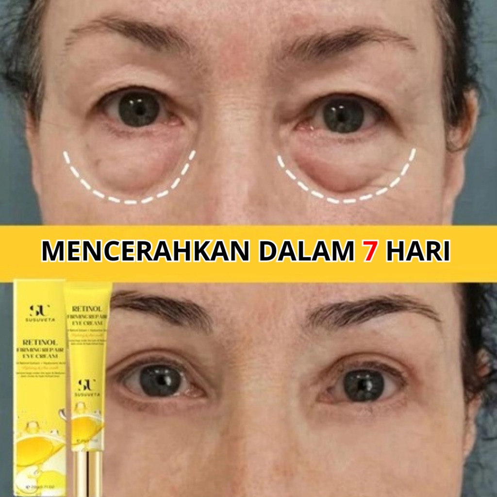 EYE CREAM RETINOL FIRMING REPAIR - MENGAHALUSKAN KERUTAN MATA/MENGENCANGKAN KULIT AREA MATA 20G