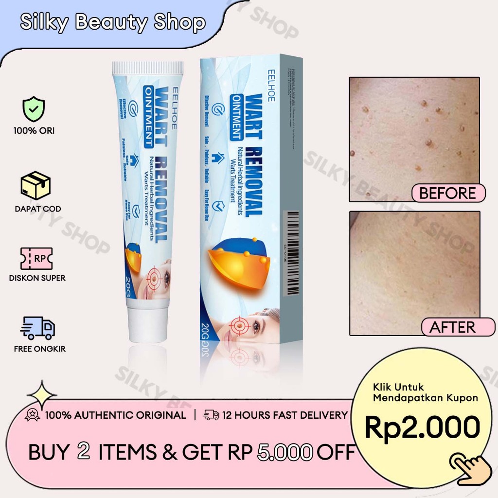 [Beli 3 Gratis 2/ORI] EELHOE Wart Removal Cream 20g Salep Penghilang Kutil Dan Tahi Lalat Ampuh Krim