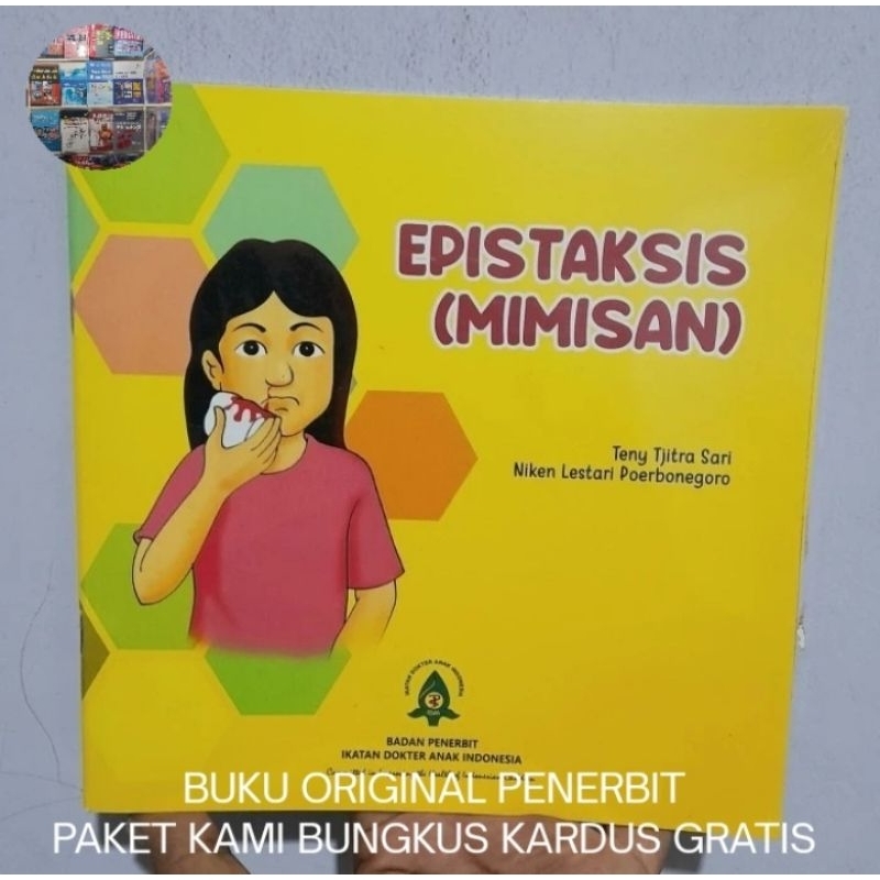 Epistaksis: Mimisan - IDAI Buku Original HVS