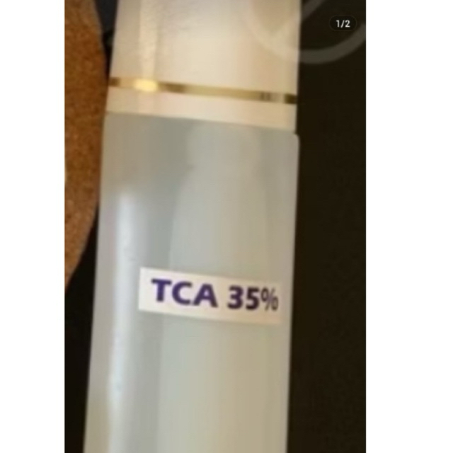 Peeling badan TCA 35% Ukuran 100 ml || Peeling pengelupasan Badan ||