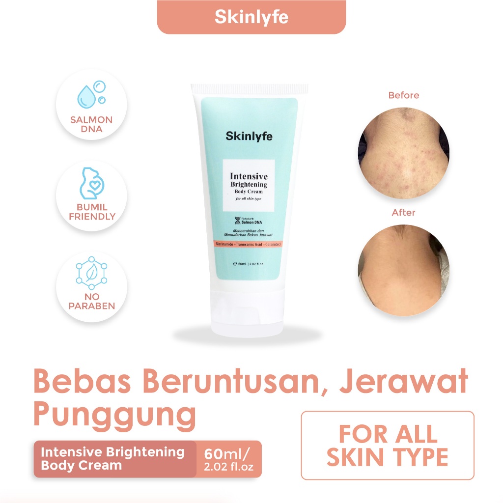 Skinlyfe Cream Pencerah Badan Penghilang Bekas Luka Hitam Koreng Obat Bekas Luka Pemutih Badan BPOM