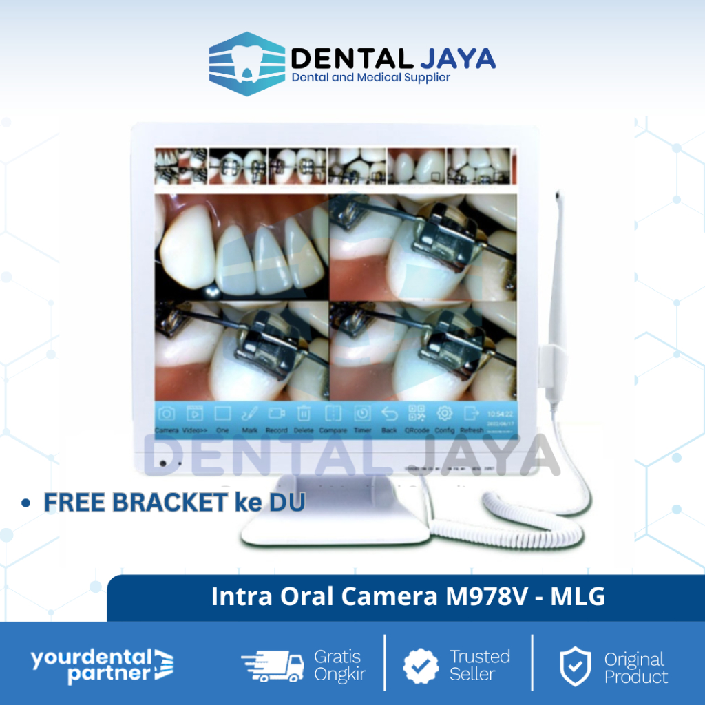 MLG Intra Oral Camera M978V Free Bracket Du