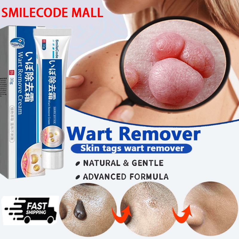 （COD）penghilang kutil ampuh salep kutil remover salep penghilang kutil di wajah wart removal cream k